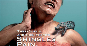 Frequently Asked Questions on Shingles or Herpes Zoster Virus shingles e1451986007483