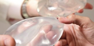 5 Things to Know About Breast Implants